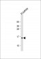 ATP5G3 Antibody (N-Term)